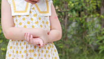 Protege a tus pequeños de los mosquitos
