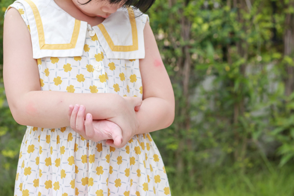 Protege a tus pequeños de los mosquitos